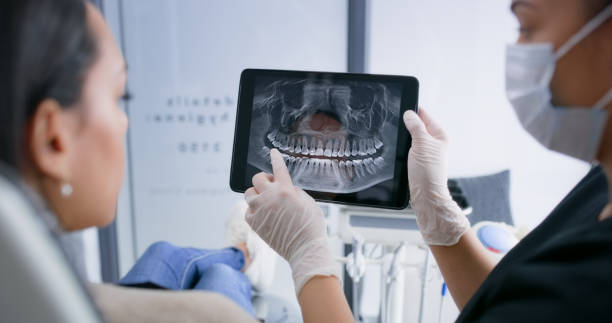 Licensed Wisdom Tooth Removal service in Spring Valley, NV - Smile Center Dentistry